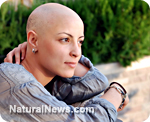 Using Hypnosis to Treat Nausea in Cancer Patients Receiving Chemotherapy
